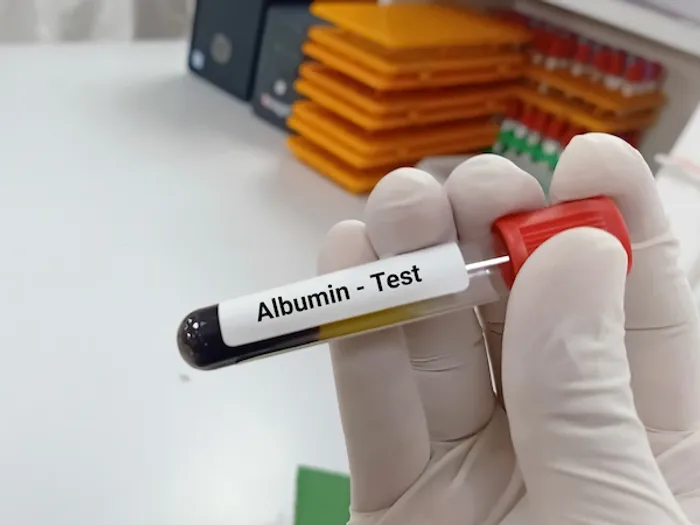 albumin test